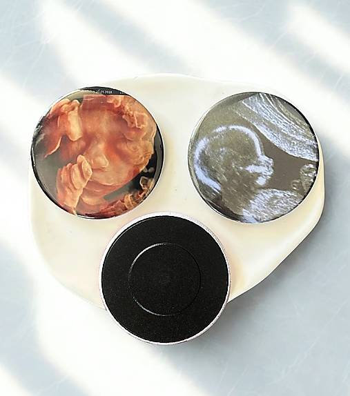 Magnetky - Magnetka s ultrazvukom, oznámenie tehotenstva, (sada 3ks), personalizované - 18066825_